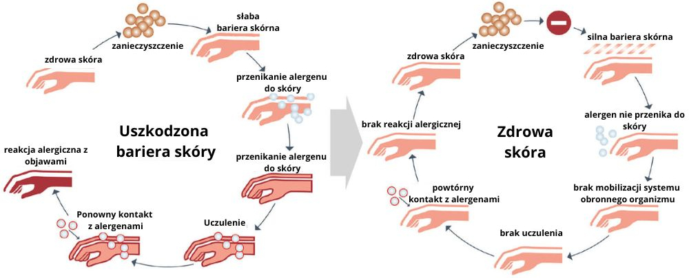 Zagrożenia dla skóry dłoni